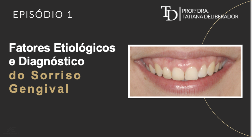 Sorriso Gengival | Fatores Etiológicos e Diagnóstico