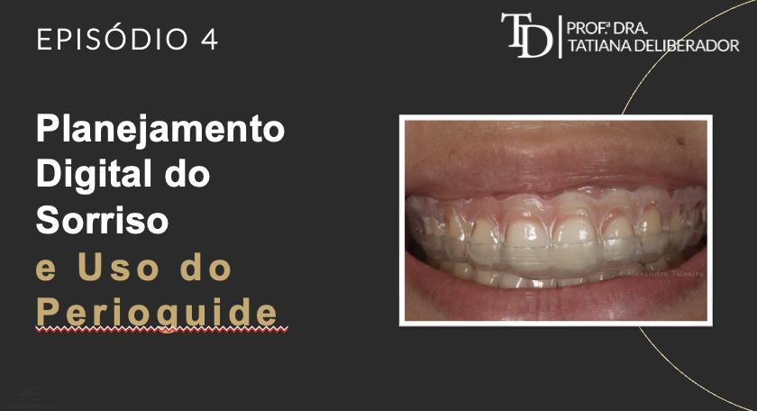 Sorriso Gengival | Planejamento Digital do Sorriso e Uso do PerioGuide
