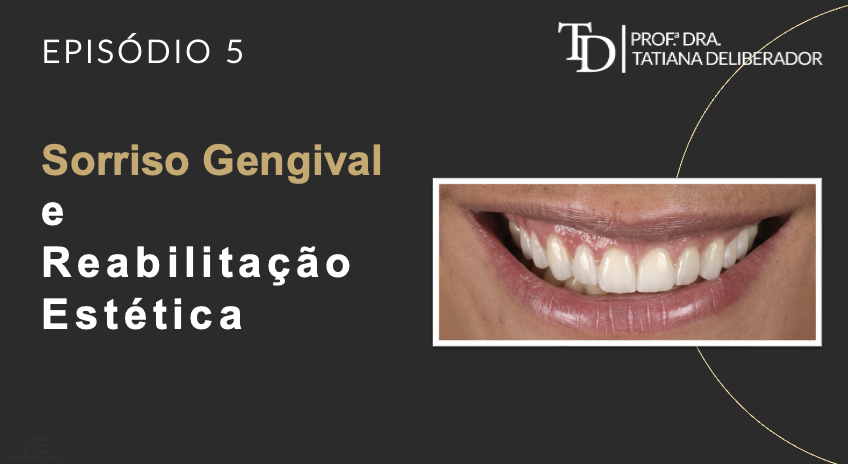 Sorriso Gengival | Correção Sorriso Gengival  associado Reabilitação Estética